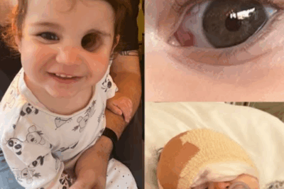 Nuala’s Fight: The Baby Who Lost an Eye but Won Her Life.2382